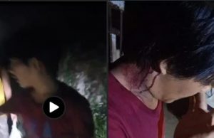 Beredar Video di Media Sosial, Seorang Pemuda Jadi Korban Begal di SP Padang