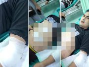 Viral, Diduga Seorang Pengunjung DA Club 41 Palembang Ditusuk dan Ditembak