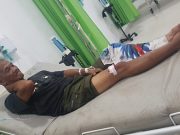 Aksi Heroik Berujung Luka, Sukmadijaya Tertembak Saat Kejar Pencuri